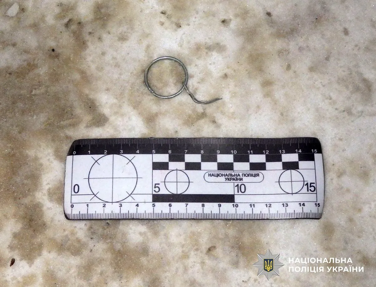 Криваве застілля у Житомирі: підривник гранати отримав ніж у живіт від гості