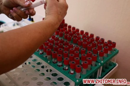 Приватна лабораторія надаватиме послуги для «Скринінгу здоров’я 40+» у Житомирі майже на 4 млн грн дешевше від очікуваної суми