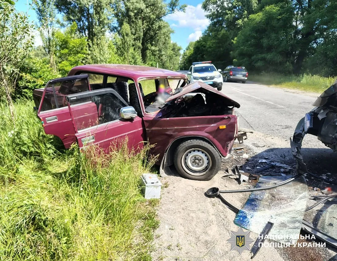 Потрійна госпіталізація внаслідок лобового зіткнення на Житомирщині